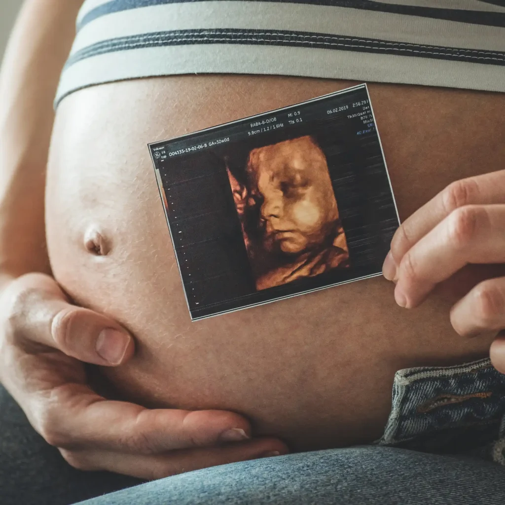 Embarazada sosteniendo junto a su vientre la imagen de una ecografía 5D del bebé